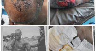 Beaten Abandoned Then Charged The Ordeal of Fredrick Namara Karuhanga