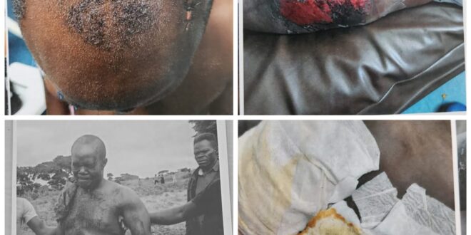 Beaten Abandoned Then Charged The Ordeal of Fredrick Namara Karuhanga