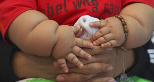 23 of SA children aged 6–14 overweight or obese Gauteng