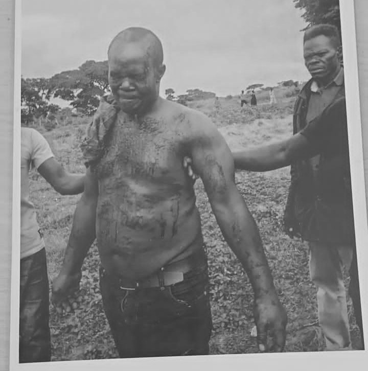 Namara stained with blood after he was rescued