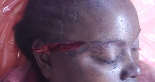 Police Launch Manhunt for Charcoal Broker Over Violent Robbery in