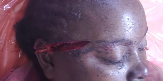 Police Launch Manhunt for Charcoal Broker Over Violent Robbery in